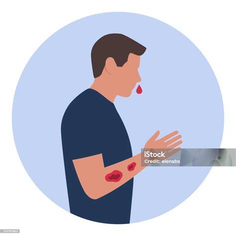 Illustration esprit d'arme tournoyante et saignement