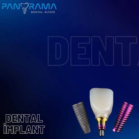 panorama dental international Rouen
